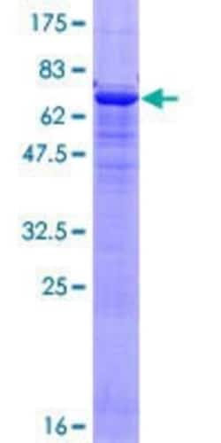 Novus Biologicals Recombinant Human Actin Alpha 1 Cardiac Muscle GST (N-Term) Protein 10 &mu;g | Buy Online | Novus Biologicals&trade; | Fisher Scientific