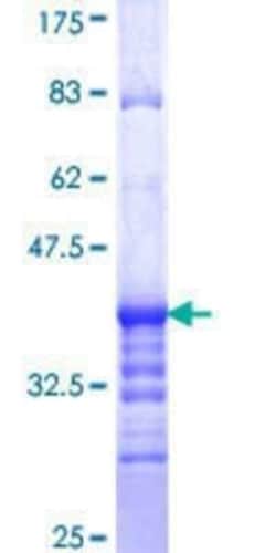Novus Biologicals Recombinant Human ATP6V1G2 GST (N-Term) Protein 10 &mu;g | Buy Online | Novus Biologicals&trade; | Fisher Scientific