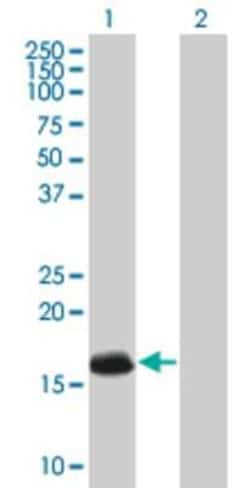 Novus Biologicals&trade;&nbsp;ATRX 293T Cell Transient Overexpression Lysate