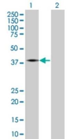 Novus Biologicals V1a Vasopressin R/AVPR1A 293T Cell Transient Overexpression