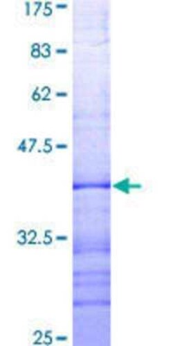 Novus Biologicals Recombinant Human Bad GST (N-Term) Protein 25 &mu;g | Buy Online | Novus Biologicals&trade; | Fisher Scientific