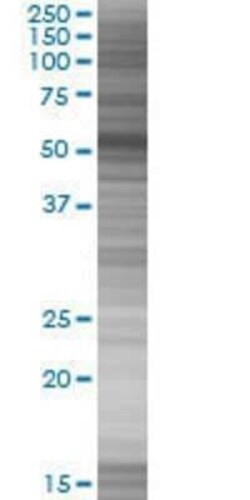 Novus Biologicals FMNL1 293T Cell Transient Overexpression Lysate 0.1 mL | Buy Online | Novus Biologicals&trade; | Fisher Scientific