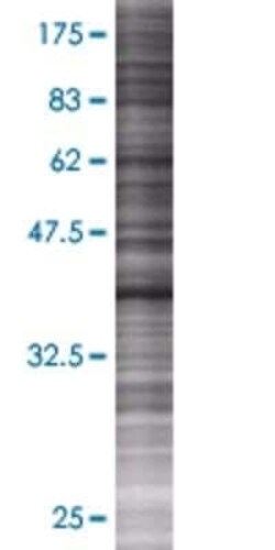 Novus Biologicals YF5 293T Cell Transient Overexpression Lysate 0.1 mL | Buy Online | Novus Biologicals&trade; | Fisher Scientific