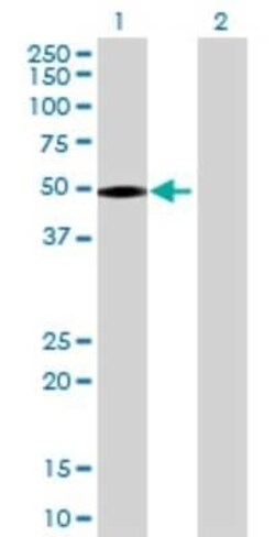 Novus Biologicals YF5 293T Cell Transient Overexpression Lysate 0.1 mL | Buy Online | Novus Biologicals&trade; | Fisher Scientific