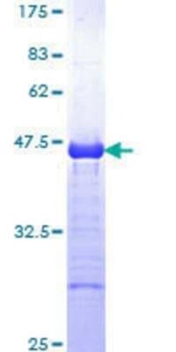 Novus Biologicals Recombinant Human CBL GST (N-Term) Protein 10 &mu;g | Buy Online | Novus Biologicals&trade; | Fisher Scientific