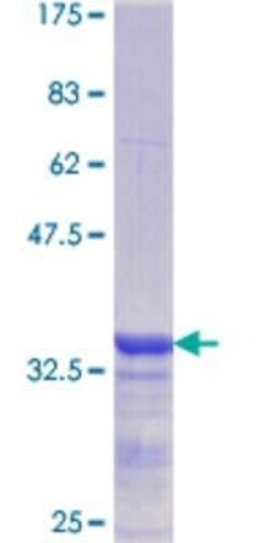 Novus Biologicals Recombinant Human CBS GST (N-Term) Protein 10 &mu;g | Buy Online | Novus Biologicals&trade; | Fisher Scientific