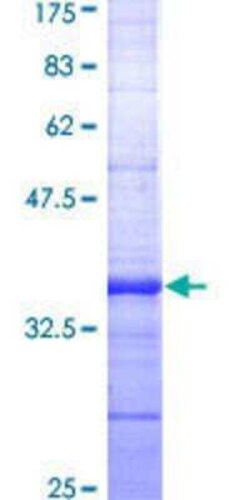 Novus Biologicals Recombinant Human Cholecystokinin-B R/CCKBR GST (N-Term) Protein 10 &mu;g | Buy Online | Novus Biologicals&trade; | Fisher Scientific
