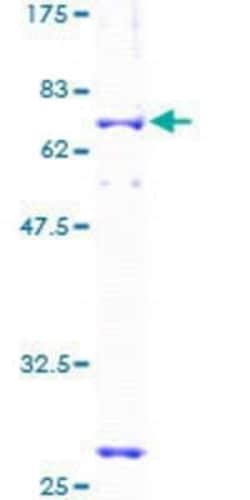 Novus Biologicals Recombinant Human Cyclin G2 GST (N-Term) Protein 10 &mu;g | Buy Online | Novus Biologicals&trade; | Fisher Scientific