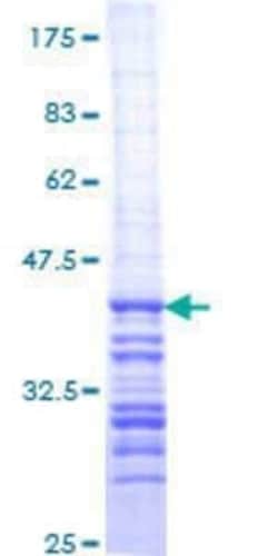 Novus Biologicals Recombinant Human Cyclin T2 GST (N-Term) Protein 10 &mu;g | Buy Online | Novus Biologicals&trade; | Fisher Scientific