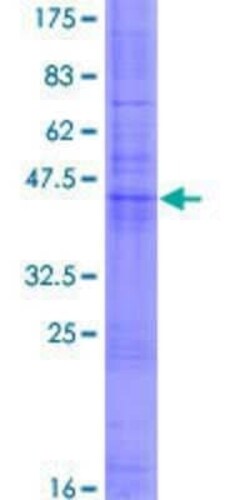 Novus Biologicals Recombinant Human CD53 GST (N-Term) Protein 2 &mu;g | Buy Online | Novus Biologicals&trade; | Fisher Scientific