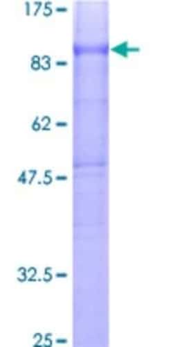 Novus Biologicals Recombinant Human CD97 GST (N-Term) Protein 2 &mu;g | Buy Online | Novus Biologicals&trade; | Fisher Scientific