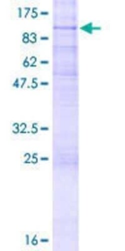 Novus Biologicals Recombinant Human CD97 GST (N-Term) Protein 2 &mu;g | Buy Online | Novus Biologicals&trade; | Fisher Scientific