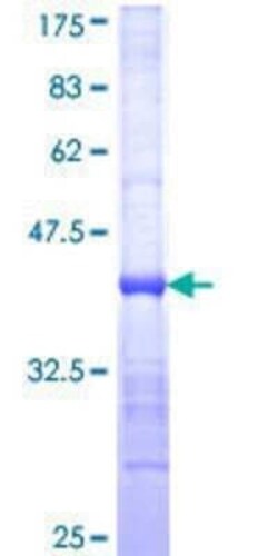 Novus Biologicals Recombinant Human CD97 GST (N-Term) Protein 10 &mu;g | Buy Online | Novus Biologicals&trade; | Fisher Scientific