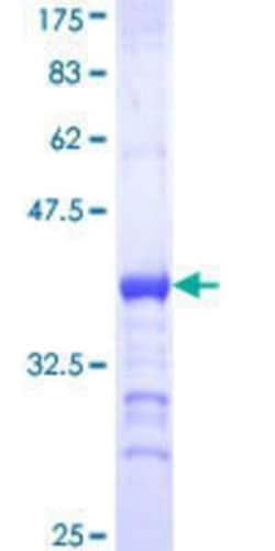 Novus Biologicals Recombinant Human CDC5L GST (N-Term) Protein 25 &mu;g | Buy Online | Novus Biologicals&trade; | Fisher Scientific