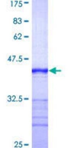 Novus Biologicals Recombinant Human Septin-7 GST (N-Term) Protein 25 &mu;g | Buy Online | Novus Biologicals&trade; | Fisher Scientific