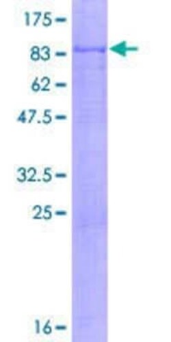 Novus Biologicals Recombinant Human Cdc6 GST (N-Term) Protein 2 &mu;g | Buy Online | Novus Biologicals&trade; | Fisher Scientific