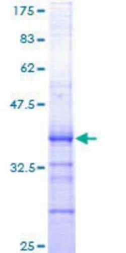 Novus Biologicals Recombinant Human Cdc6 GST (N-Term) Protein 25 &mu;g | Buy Online | Novus Biologicals&trade; | Fisher Scientific