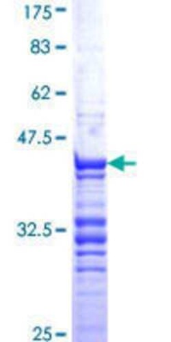 Novus Biologicals Recombinant Human Cdc20 GST (N-Term) Protein 10 &mu;g | Buy Online | Novus Biologicals&trade; | Fisher Scientific