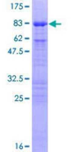 Novus Biologicals Recombinant Human CDC25C GST (N-Term) Protein 10 &mu;g | Buy Online | Novus Biologicals&trade; | Fisher Scientific