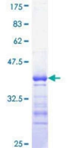 Novus Biologicals Recombinant Human CDC25C GST (N-Term) Protein 25 &mu;g | Buy Online | Novus Biologicals&trade; | Fisher Scientific