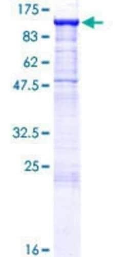 Novus Biologicals Recombinant Human Cadherin-16 GST (N-Term) Protein 25 &mu;g | Buy Online | Novus Biologicals&trade; | Fisher Scientific