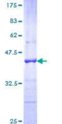Novus Biologicals Recombinant Human Cadherin-18 GST (N-Term) Protein 25 &mu;g | Buy Online | Novus Biologicals&trade; | Fisher Scientific