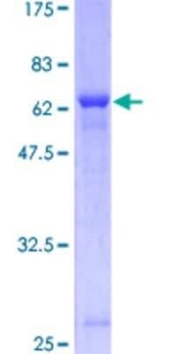 Novus Biologicals Recombinant Human Cdk6 GST (N-Term) Protein 25 &mu;g | Buy Online | Novus Biologicals&trade; | Fisher Scientific