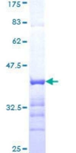 Novus Biologicals Recombinant Human Cdk6 GST (N-Term) Protein 25 &mu;g | Buy Online | Novus Biologicals&trade; | Fisher Scientific
