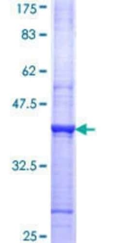 Novus Biologicals Recombinant Human Cdk6 GST (N-Term) Protein 10 &mu;g | Buy Online | Novus Biologicals&trade; | Fisher Scientific