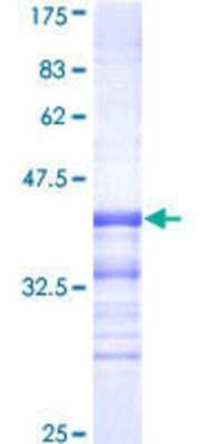 Novus Biologicals Recombinant Human CDK8 GST (N-Term) Protein 10 &mu;g | Buy Online | Novus Biologicals&trade; | Fisher Scientific