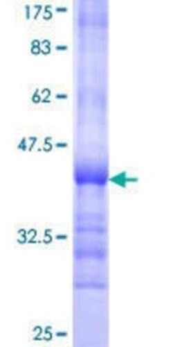 Novus Biologicals Recombinant Human Cdk9 GST (N-Term) Protein 25 &mu;g | Buy Online | Novus Biologicals&trade; | Fisher Scientific