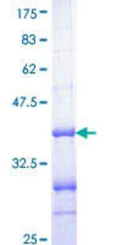 Novus Biologicals Recombinant Human p57 Kip2 GST (N-Term) Protein 25 &mu;g | Buy Online | Novus Biologicals&trade; | Fisher Scientific