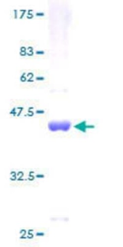 Novus Biologicals Recombinant Human p15INK4b/CDKN2B GST (N-Term) Protein 25 &mu;g | Buy Online | Novus Biologicals&trade; | Fisher Scientific