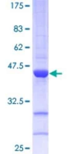 Novus Biologicals Recombinant Human p19 INK4d GST (N-Term) Protein 25 &mu;g | Buy Online | Novus Biologicals&trade; | Fisher Scientific