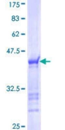 Novus Biologicals Recombinant Human CDR2 GST (N-Term) Protein 25 &mu;g | Buy Online | Novus Biologicals&trade; | Fisher Scientific