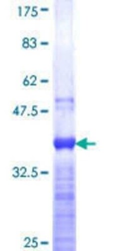 Novus Biologicals Recombinant Human Cdx1 GST (N-Term) Protein 10 &mu;g | Buy Online | Novus Biologicals&trade; | Fisher Scientific