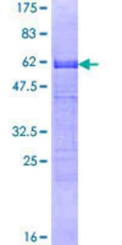 Novus Biologicals&trade;&nbsp;Recombinant Human CDX2 GST (N-Term) Protein