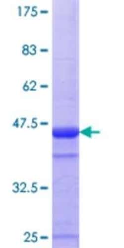 Novus Biologicals Recombinant Human CLGN GST (N-Term) Protein 10 &mu;g | Buy Online | Novus Biologicals&trade; | Fisher Scientific
