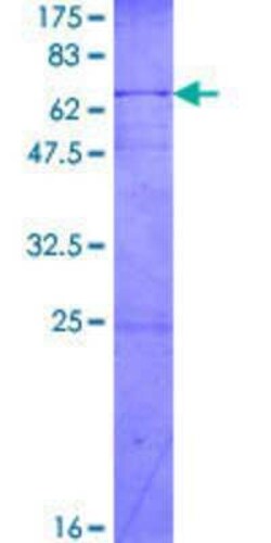 Novus Biologicals Recombinant Human CEBP epsilon GST (N-Term) Protein 2 &mu;g | Buy Online | Novus Biologicals&trade; | Fisher Scientific