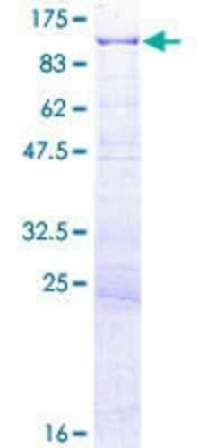 Novus Biologicals Recombinant Human CENPC GST (N-Term) Protein 2 &mu;g | Buy Online | Novus Biologicals&trade; | Fisher Scientific