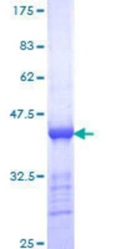 Novus Biologicals Recombinant Human CENPE GST (N-Term) Protein 25 &mu;g | Buy Online | Novus Biologicals&trade; | Fisher Scientific