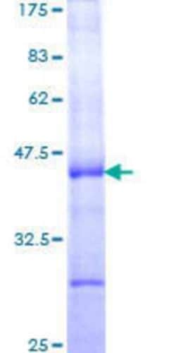 Novus Biologicals Recombinant Human Chorionic Gonadotropin alpha Chain (hCG alpha) GST (N-Term) Protein 25 &mu;g | Buy Online | Novus Biologicals&trade; | Fisher Scientific