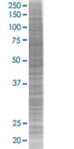 Novus Biologicals Chorionic Gonadotropin beta Chain (hCG beta) 293T Cell Transient Overexpression Lysate 0.1 mL | Buy Online | Novus Biologicals&trade; | Fisher Scientific