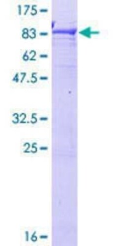 Novus Biologicals Recombinant Human RCBTB2 GST (N-Term) Protein 10 &mu;g | Buy Online | Novus Biologicals&trade; | Fisher Scientific