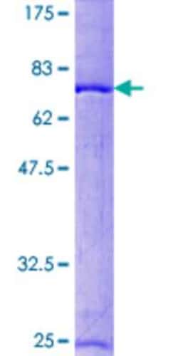 Novus Biologicals Recombinant Human RCC1 GST (N-Term) Protein 10 &mu;g | Buy Online | Novus Biologicals&trade; | Fisher Scientific
