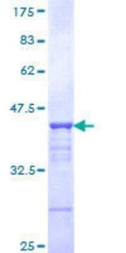 Novus Biologicals Recombinant Human CHD3 GST (N-Term) Protein 25 &mu;g | Buy Online | Novus Biologicals&trade; | Fisher Scientific