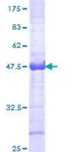 Novus Biologicals Recombinant Human CHD4 GST (N-Term) Protein 25 &mu;g | Buy Online | Novus Biologicals&trade; | Fisher Scientific