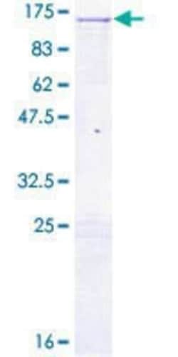 Novus Biologicals Recombinant Human Chromogranin B GST (N-Term) Protein 10 &mu;g | Buy Online | Novus Biologicals&trade; | Fisher Scientific
