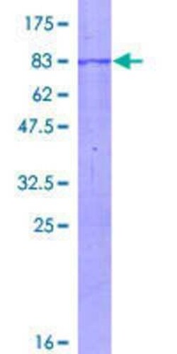 Novus Biologicals Recombinant Human Choline kinase alpha GST (N-Term) Protein 10 &mu;g | Buy Online | Novus Biologicals&trade; | Fisher Scientific