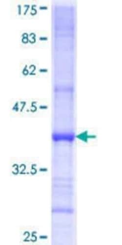 Novus Biologicals Recombinant Human Choline kinase alpha GST (N-Term) Protein 10 &mu;g | Buy Online | Novus Biologicals&trade; | Fisher Scientific